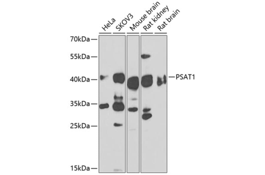 Western Blot - Anti-PSAT1 Antibody (A14124) - Antibodies.com
