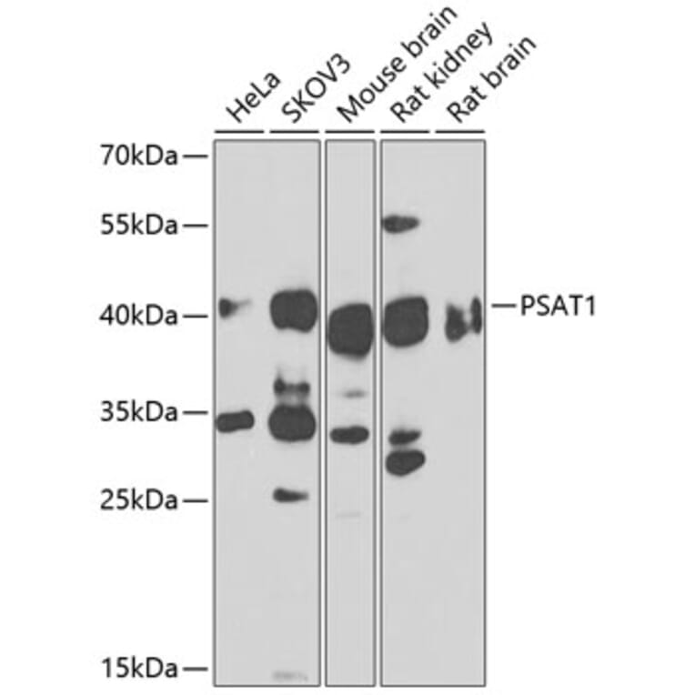 Western Blot - Anti-PSAT1 Antibody (A14124) - Antibodies.com