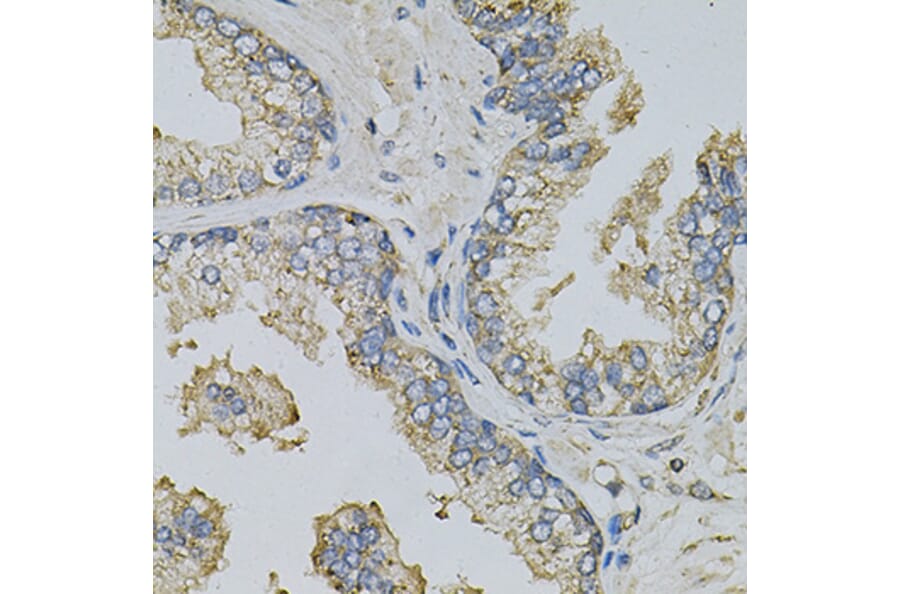Immunohistochemistry - Anti-PSAT1 Antibody (A14124) - Antibodies.com
