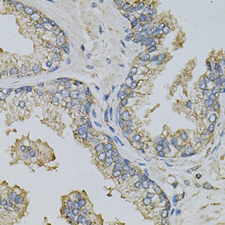 Immunohistochemistry - Anti-PSAT1 Antibody (A14124) - Antibodies.com