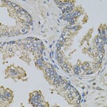 Immunohistochemistry - Anti-PSAT1 Antibody (A14124) - Antibodies.com