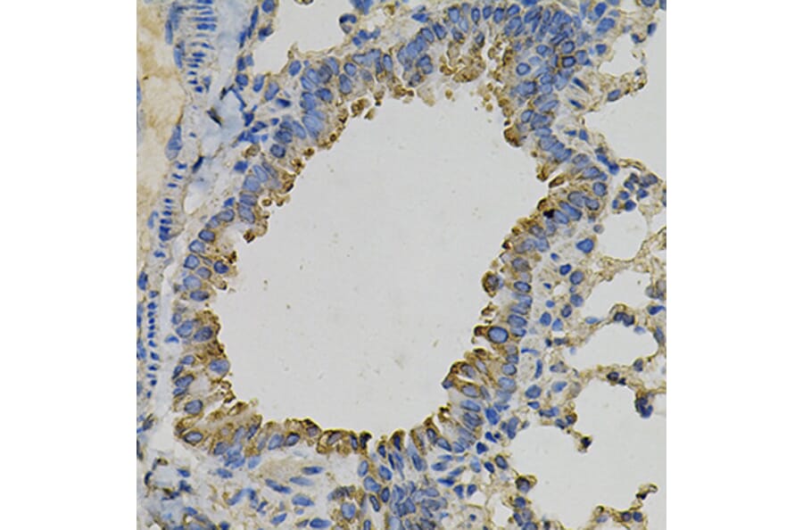 Immunohistochemistry - Anti-PSAT1 Antibody (A14124) - Antibodies.com