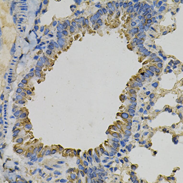 Immunohistochemistry - Anti-PSAT1 Antibody (A14124) - Antibodies.com