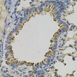Immunohistochemistry - Anti-PSAT1 Antibody (A14124) - Antibodies.com