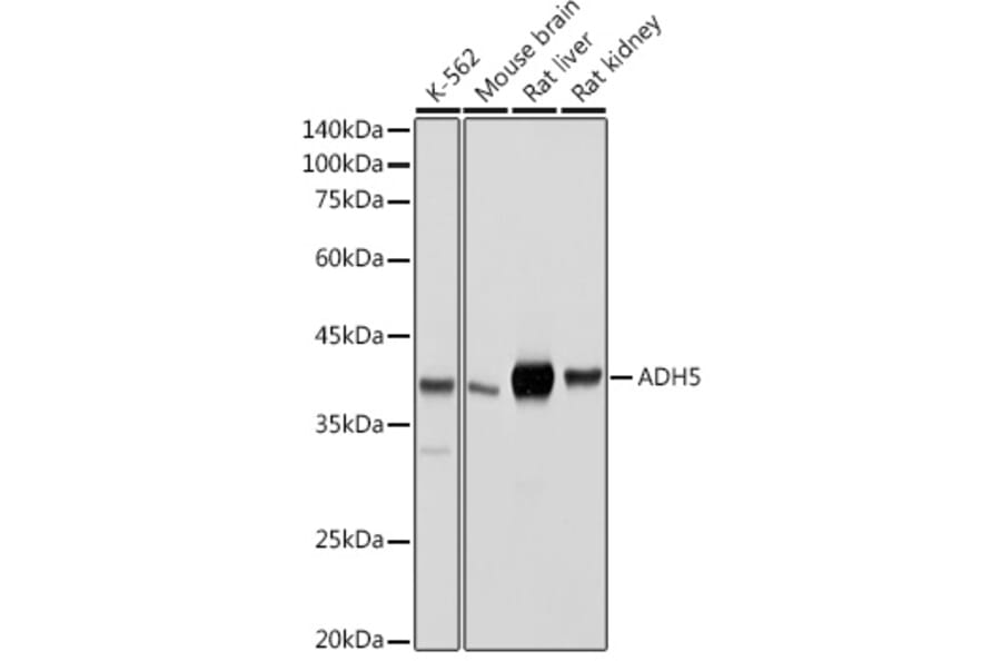 Western Blot - Anti-ADH5 Antibody (A89734) - Antibodies.com