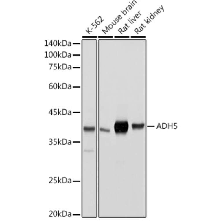 Western Blot - Anti-ADH5 Antibody (A89734) - Antibodies.com