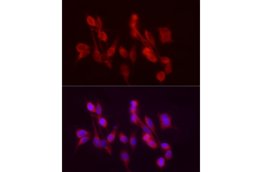 Immunofluorescence - Anti-ADH5 Antibody (A89734) - Antibodies.com
