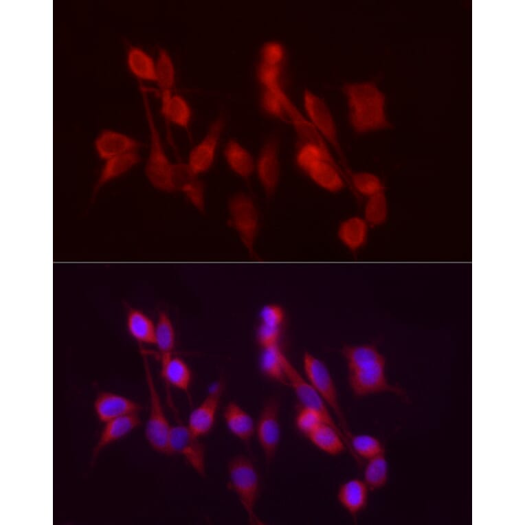 Immunofluorescence - Anti-ADH5 Antibody (A89734) - Antibodies.com