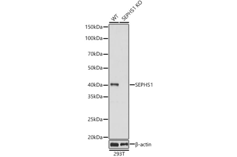 Western Blot - Anti-Selenophosphate synthetase 1 Antibody (A89735) - Antibodies.com
