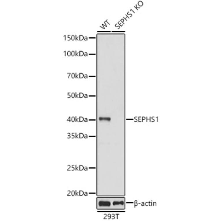 Western Blot - Anti-Selenophosphate synthetase 1 Antibody (A89735) - Antibodies.com