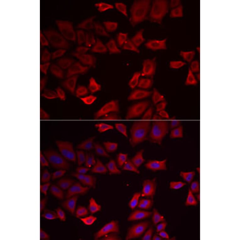 Immunofluorescence - Anti-Selenophosphate synthetase 1 Antibody (A89735) - Antibodies.com