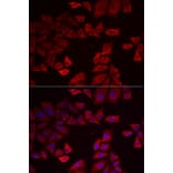 Immunofluorescence - Anti-Selenophosphate synthetase 1 Antibody (A89735) - Antibodies.com