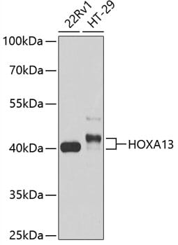 Western blot analysis of extracts of various cell lines, using Anti-HOXA13 Antibody (A13999) at 1:1,000 dilution.
Secondary antibody: Goat Anti-Rabbit IgG (H+L) (HRP) (AS014) at 1:10,000 dilution.
Lysates / proteins: 25µg per lane.
Blocking buffer: 3% non-fat dry milk in TBST.
Detection: ECL Basic Kit (RM00020).
Exposure time: 30s.