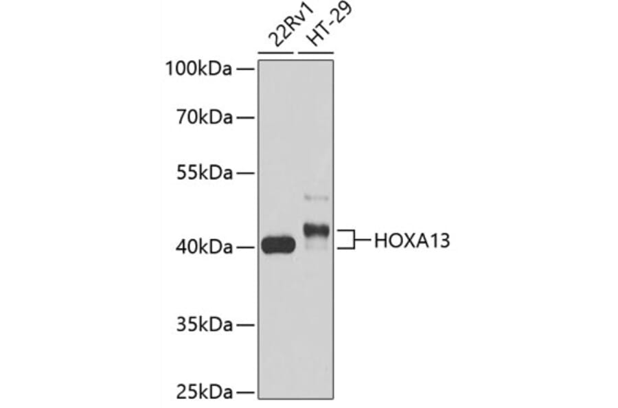 Western Blot - Anti-HOXA13 Antibody (A89737) - Antibodies.com