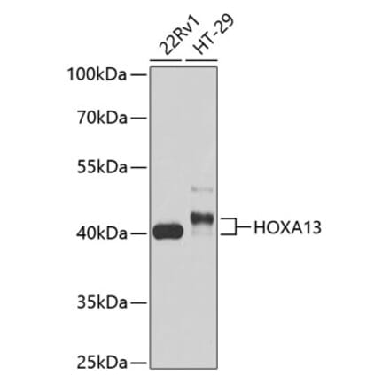 Western Blot - Anti-HOXA13 Antibody (A89737) - Antibodies.com