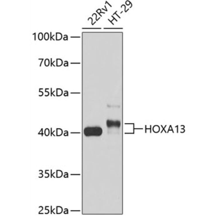 Western Blot - Anti-HOXA13 Antibody (A89737) - Antibodies.com