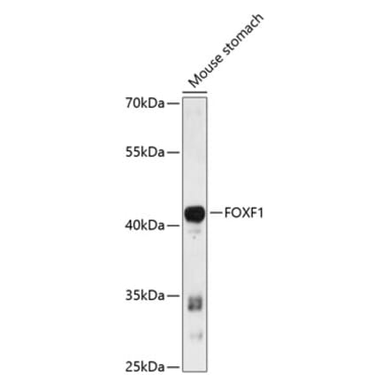 Western Blot - Anti-FOXF1 Antibody (A89738) - Antibodies.com