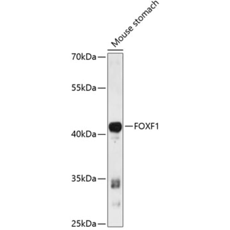 Western Blot - Anti-FOXF1 Antibody (A89738) - Antibodies.com