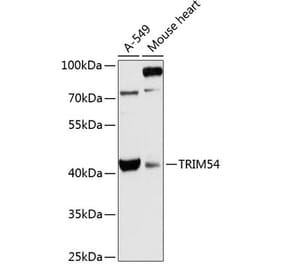 Western Blot - Anti-TRIM54 Antibody (A89740) - Antibodies.com