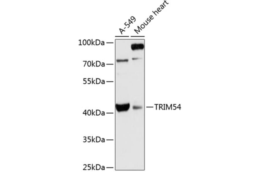 Western Blot - Anti-TRIM54 Antibody (A89740) - Antibodies.com