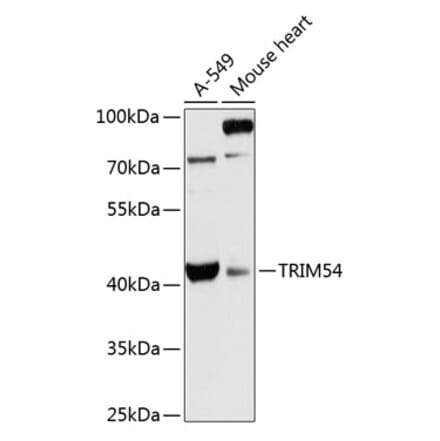 Western Blot - Anti-TRIM54 Antibody (A89740) - Antibodies.com