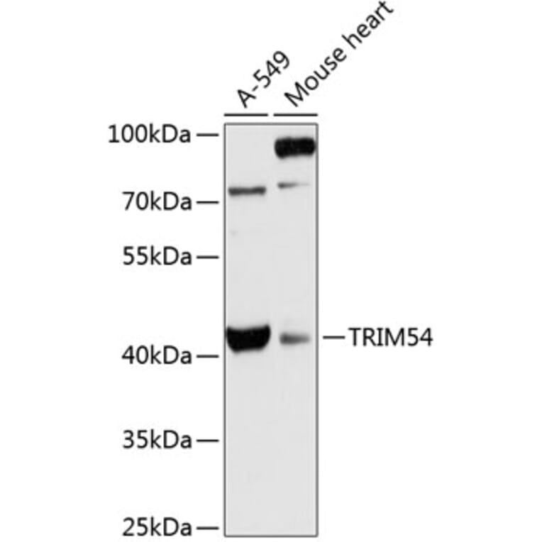 Western Blot - Anti-TRIM54 Antibody (A89740) - Antibodies.com