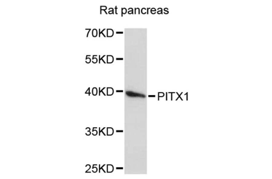 Western Blot - Anti-PITX1 Antibody (A4022) - Antibodies.com