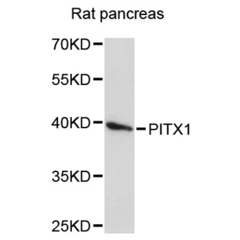 Western Blot - Anti-PITX1 Antibody (A4022) - Antibodies.com