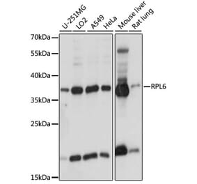 Western Blot - Anti-RPL6 Antibody (A89742) - Antibodies.com