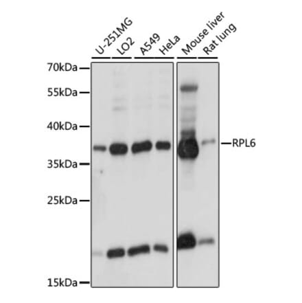 Western Blot - Anti-RPL6 Antibody (A89742) - Antibodies.com