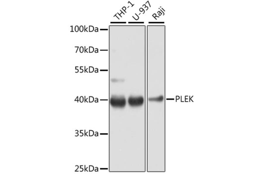 Western Blot - Anti-PLEK Antibody (A13338) - Antibodies.com