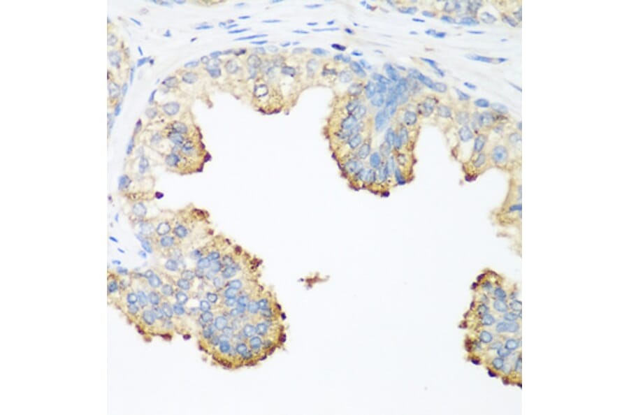 Immunohistochemistry - Anti-PLEK Antibody (A13338) - Antibodies.com