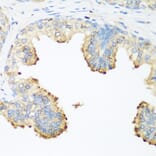 Immunohistochemistry - Anti-PLEK Antibody (A13338) - Antibodies.com
