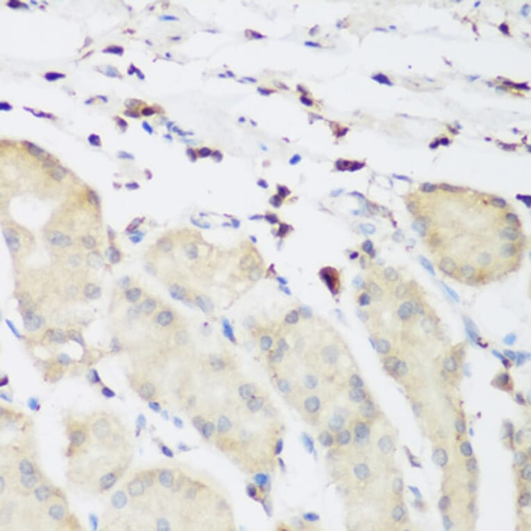 Immunohistochemistry - Anti-PLEK Antibody (A13338) - Antibodies.com
