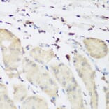 Immunohistochemistry - Anti-PLEK Antibody (A13338) - Antibodies.com