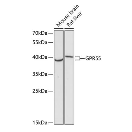 Western Blot - Anti-GPCR GPR55 Antibody (A89744) - Antibodies.com