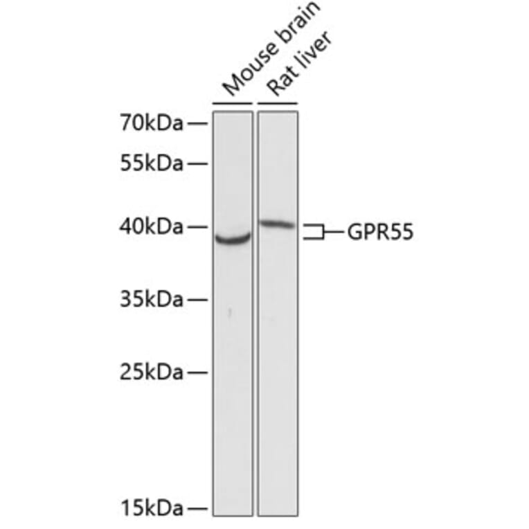 Western Blot - Anti-GPCR GPR55 Antibody (A89744) - Antibodies.com