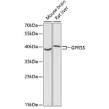 Western Blot - Anti-GPCR GPR55 Antibody (A89744) - Antibodies.com