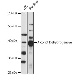 Western Blot - Anti-Alcohol Dehydrogenase Antibody (A89745) - Antibodies.com