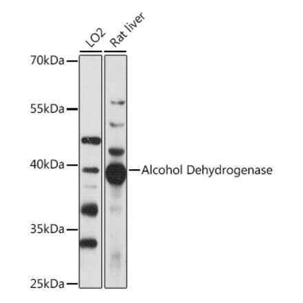 Western Blot - Anti-Alcohol Dehydrogenase Antibody (A89745) - Antibodies.com