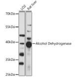Western Blot - Anti-Alcohol Dehydrogenase Antibody (A89745) - Antibodies.com