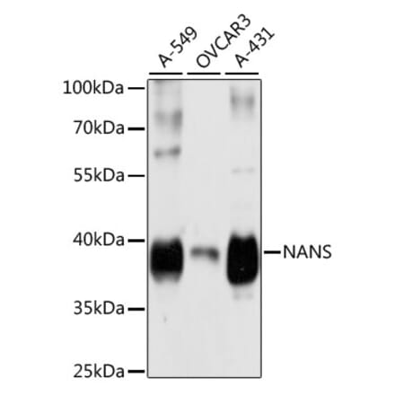 Western Blot - Anti-NANS Antibody (A89746) - Antibodies.com
