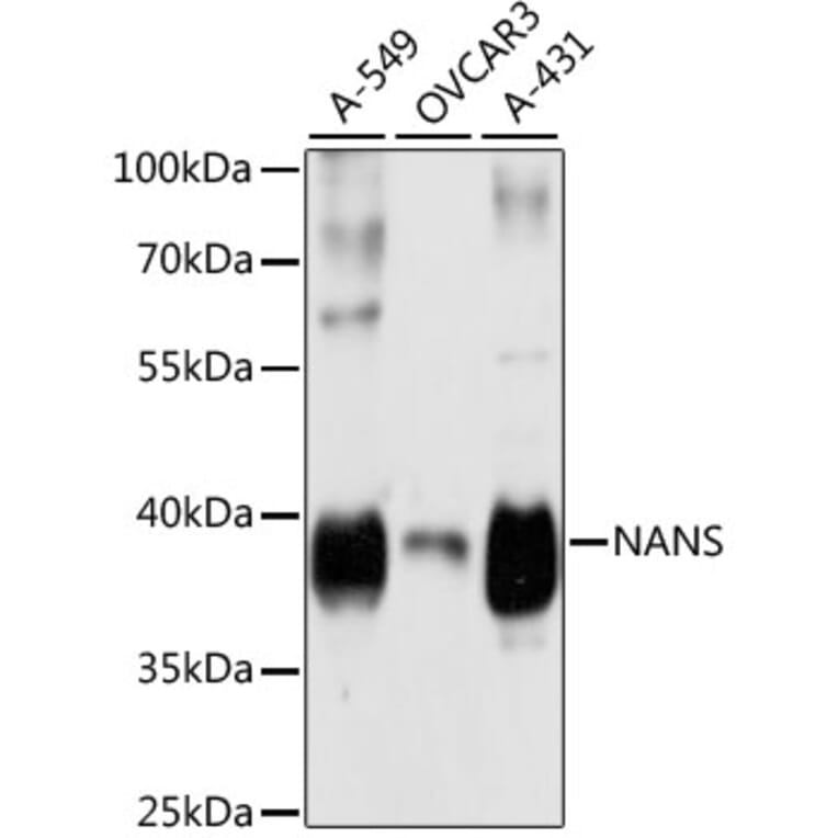Western Blot - Anti-NANS Antibody (A89746) - Antibodies.com