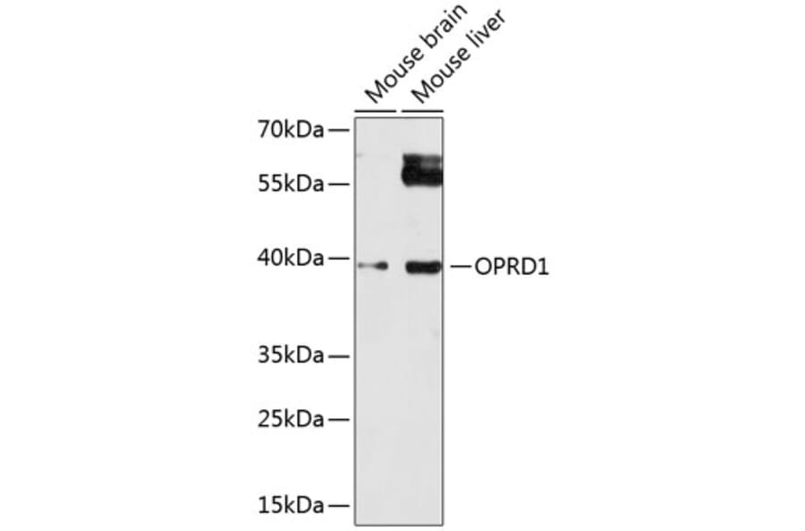Western Blot - Anti-OPRD1 Antibody (A14207) - Antibodies.com