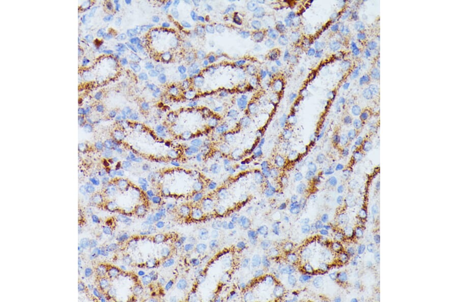 Immunohistochemistry - Anti-IDH3A Antibody (A89748) - Antibodies.com
