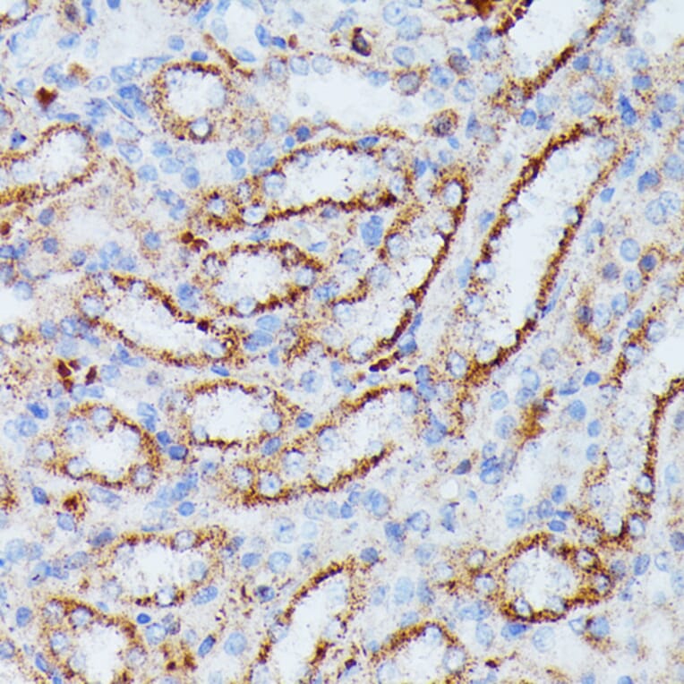 Immunohistochemistry - Anti-IDH3A Antibody (A89748) - Antibodies.com