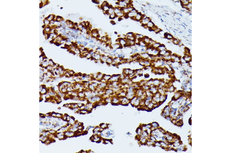 Immunohistochemistry - Anti-IDH3A Antibody (A89748) - Antibodies.com