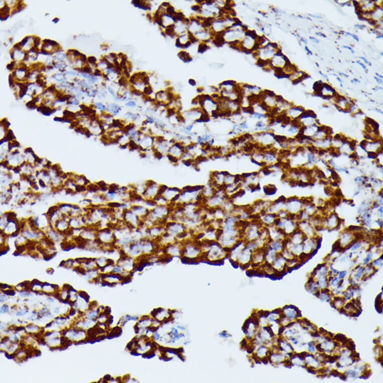 Immunohistochemistry - Anti-IDH3A Antibody (A89748) - Antibodies.com