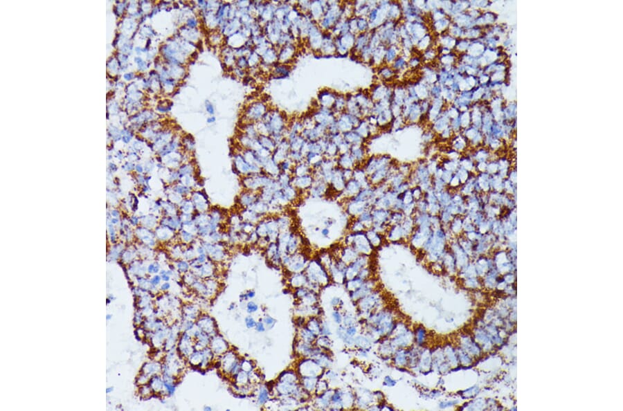 Immunohistochemistry - Anti-IDH3A Antibody (A89748) - Antibodies.com