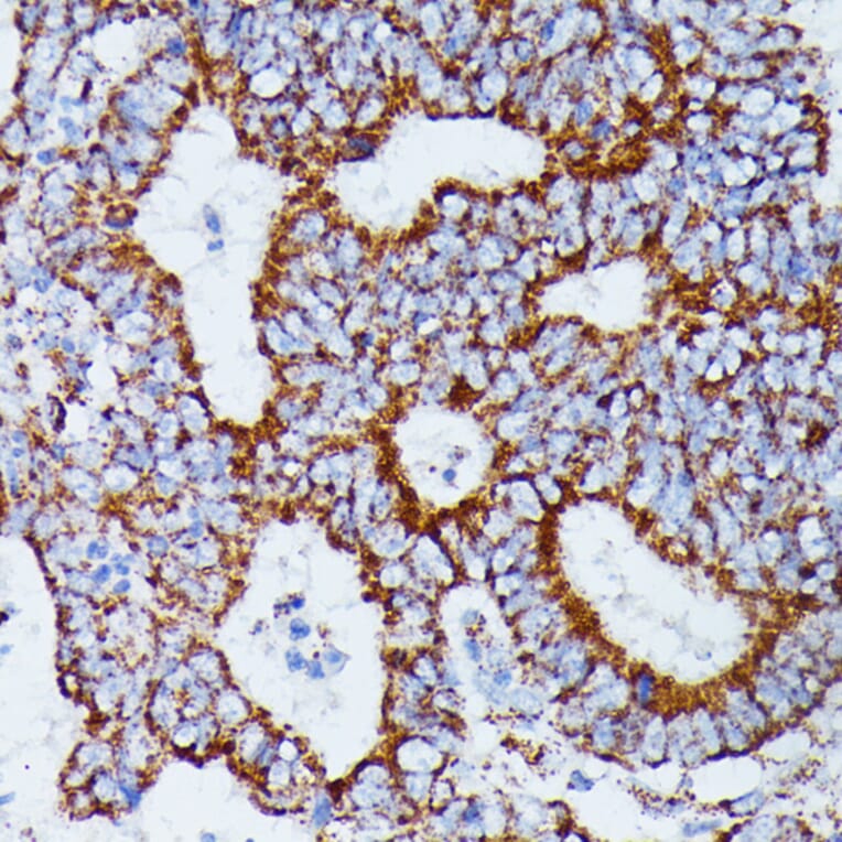 Immunohistochemistry - Anti-IDH3A Antibody (A89748) - Antibodies.com